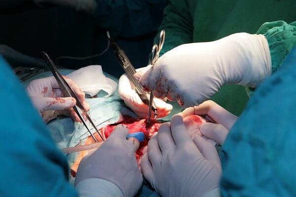 Laryngectomy with Neck Dissection